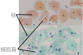 子宮頸癌の検査 1 癌細胞をみてみよう 子宮がん検診に行こう