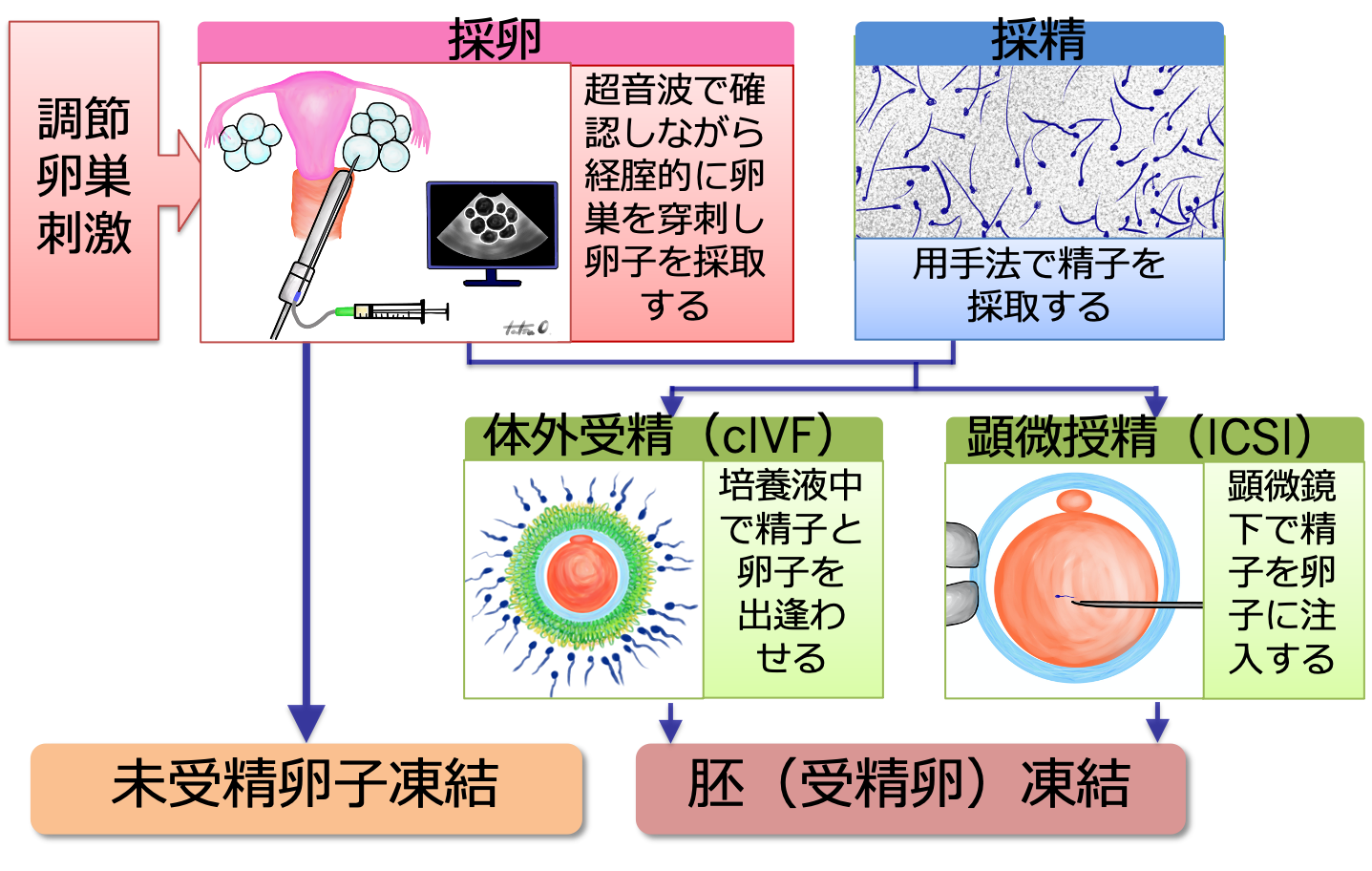 胚凍結